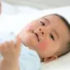 bébé atteint d'épidermolyse bulleuse avec des cloques sur la peau