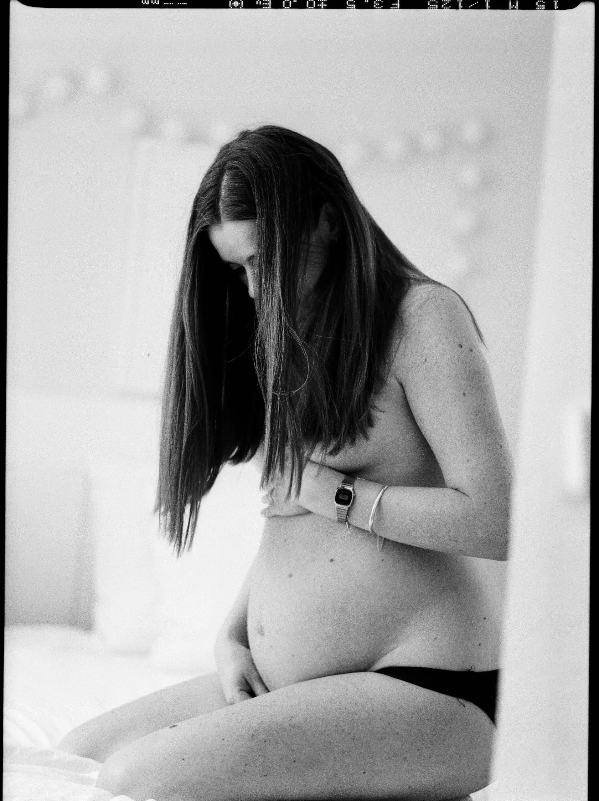 Traiter les vergetures pendant la grossesse